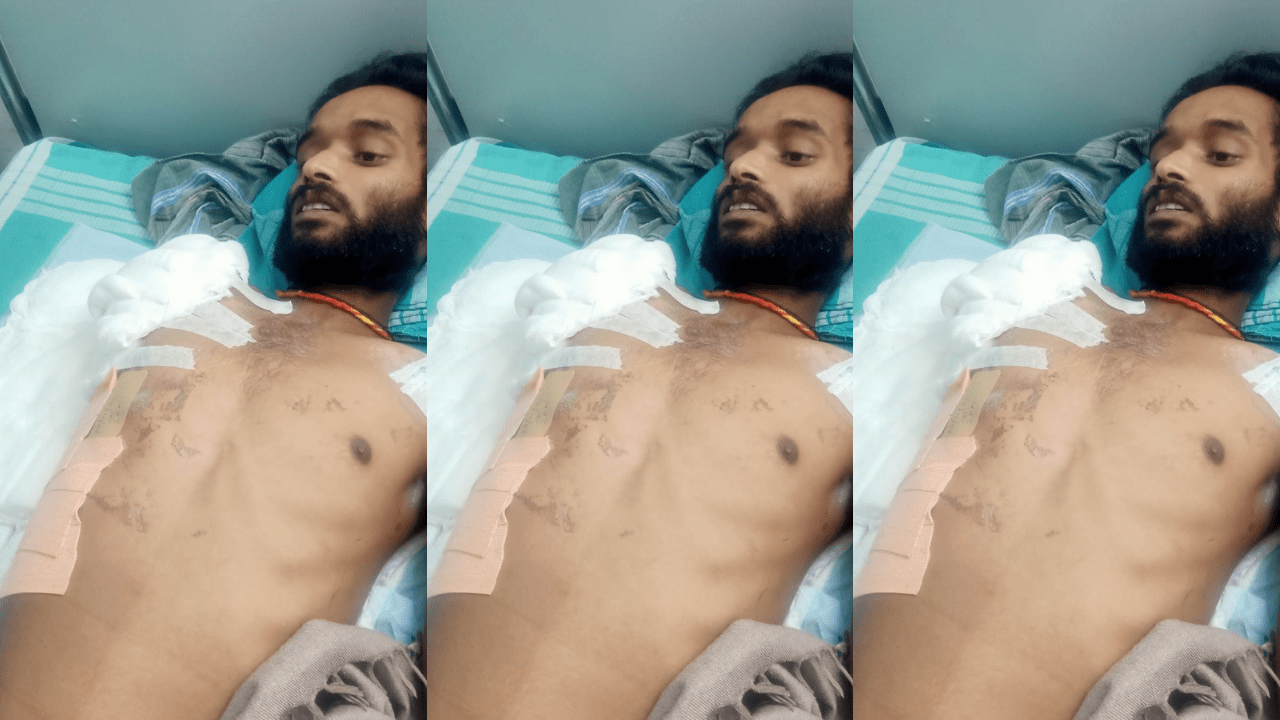 بھارت، بنگلورو پولیس کا چوری کے الزام میں گرفتار نوجوان کو شدید نقصان